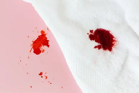 Krev na oblečení: Umění a triky na odstranění